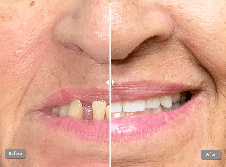 Before and After Photo 1