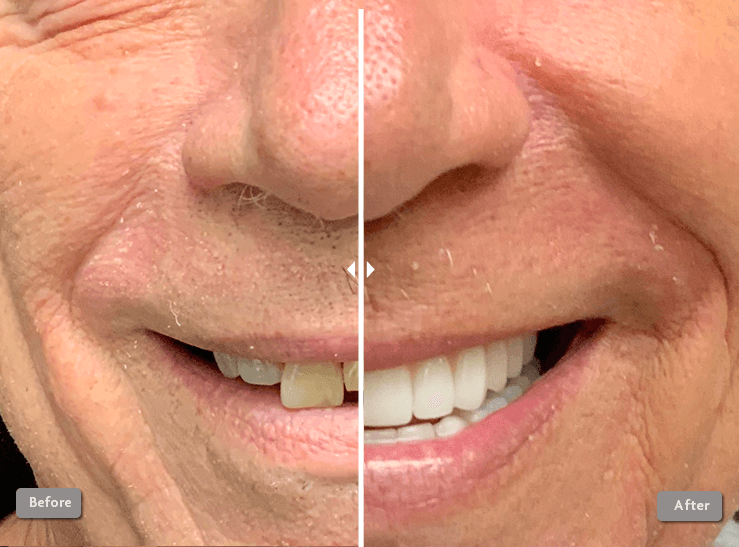 Before and After Photo 2