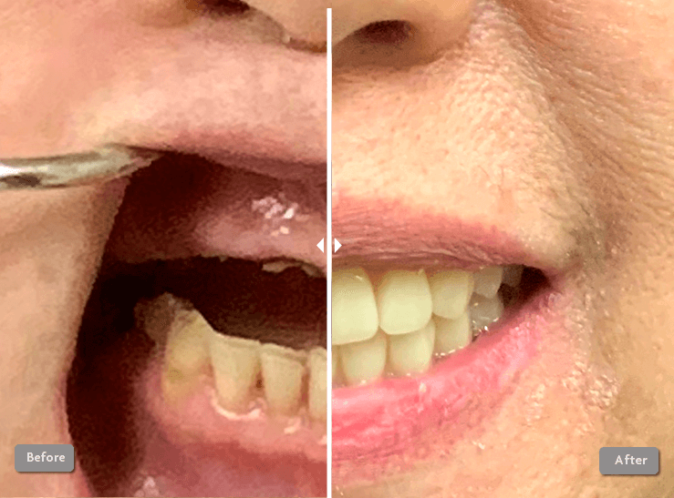 Before and After Photo 3