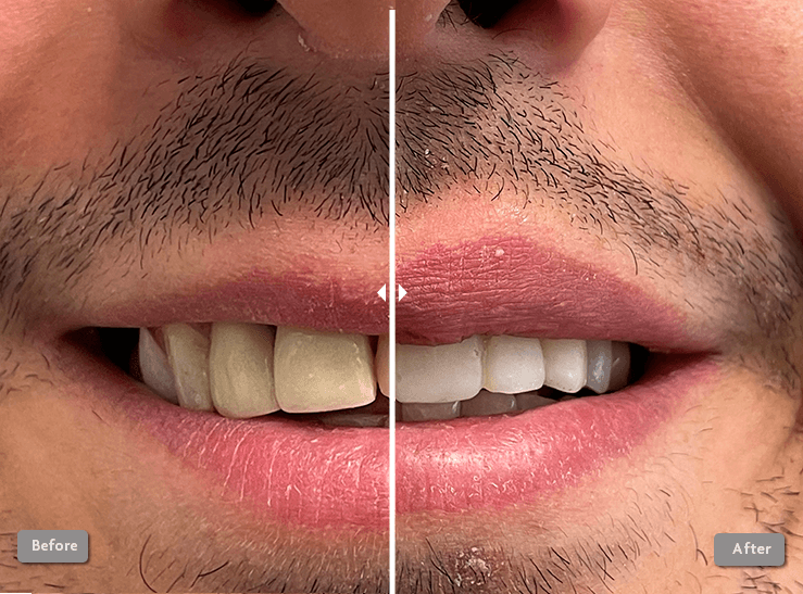 Before and After Photo 4